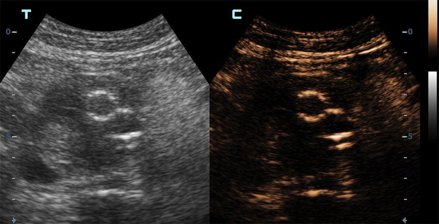 evar debut contraste