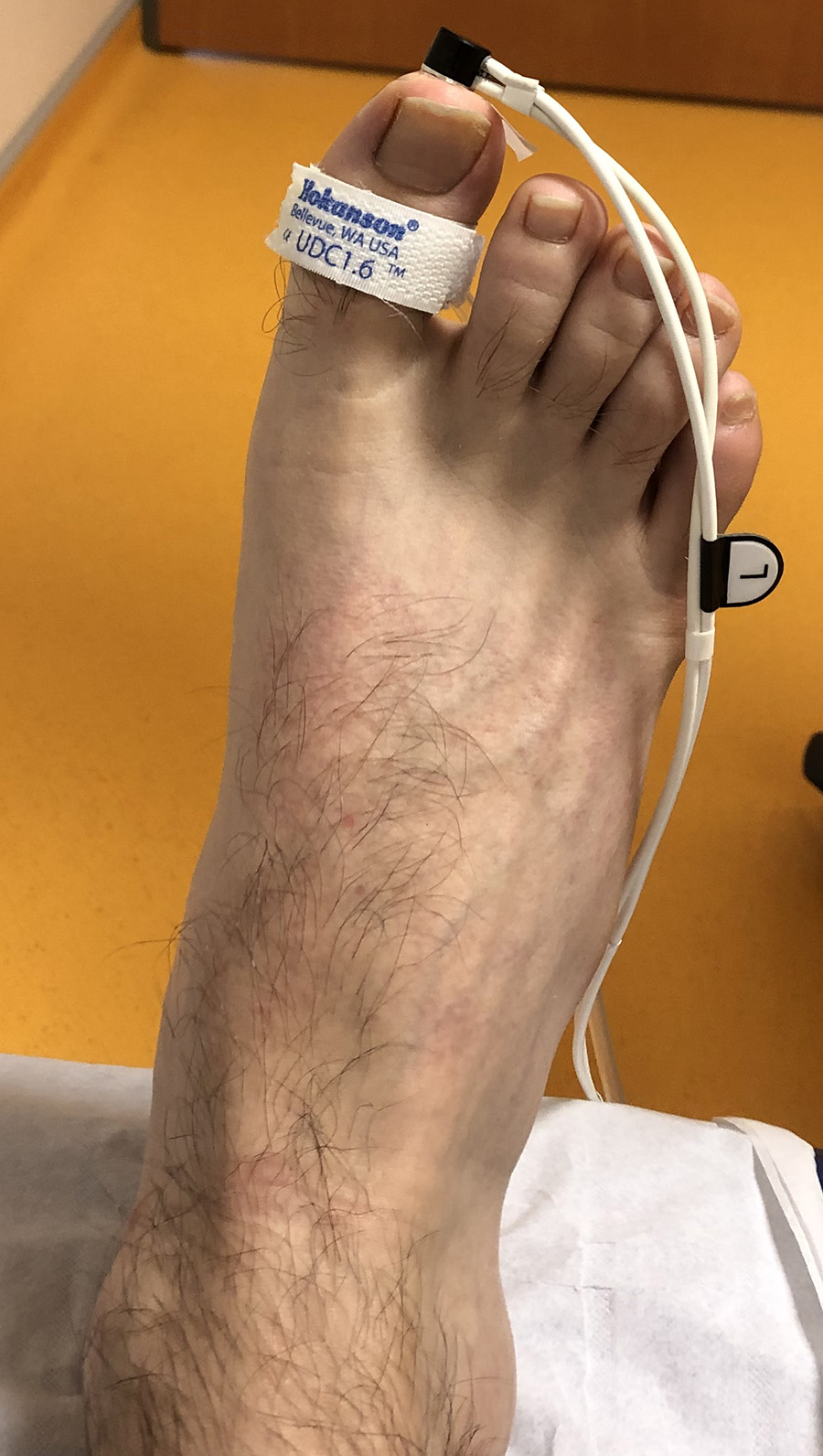 pied pgo